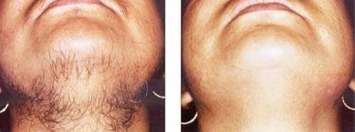 Sri Gayatri Cosmetics Skin Care and Hair Transplant Cetre