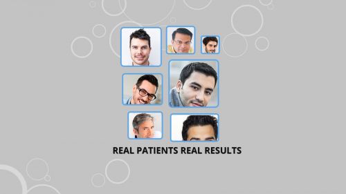 Portfolio image from Athena Hair Now Hair Transplant